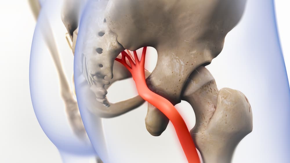 Can A Car Accident Cause A Pinched Nerve? 17 Pinched Nerves After a Car Accident