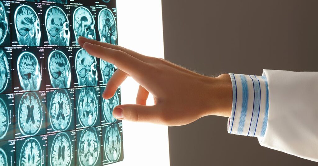 traumatic brain injuries nebraska